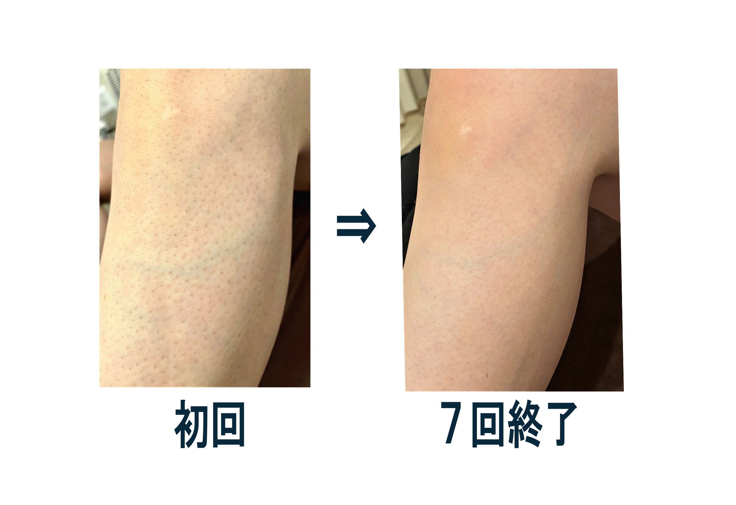 ありがとうございます 河辺駅で脱毛 痩身 エステのsalon De Gym Reir レイール